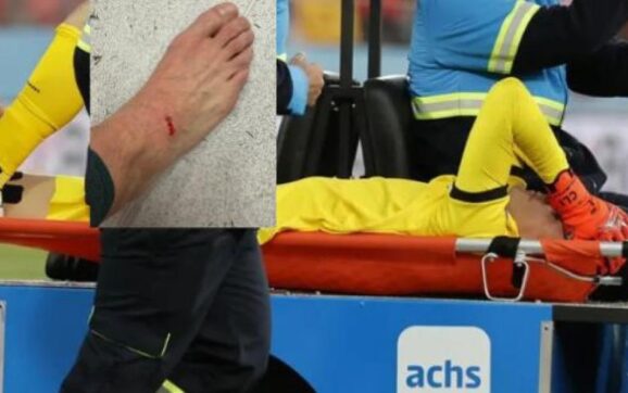 Lampe sufre nuevo percance en Santiago tras grave lesión anterior