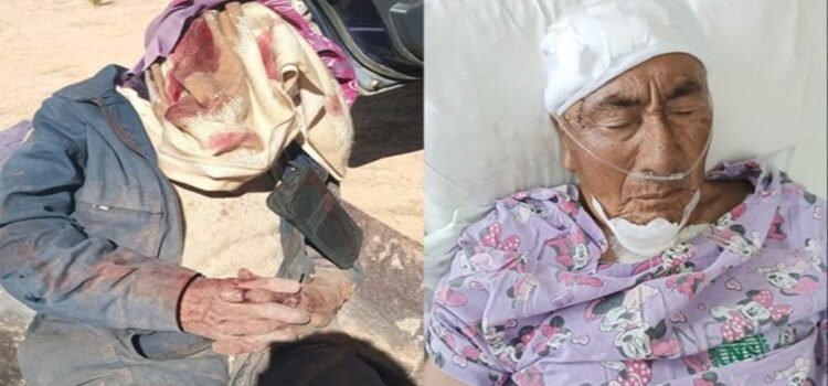 Buscan a hombre por brutal ataque con picota a su tío de 77 años