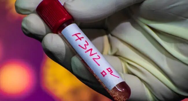 Sedes activa vigilancia epidemiológica en Santa Cruz tras brote de Gripe K