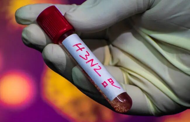 Sedes activa vigilancia epidemiológica en Santa Cruz tras brote de Gripe K