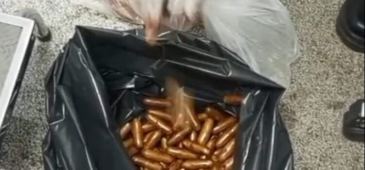 Boliviana en Brasil recibe operación de urgencia tras ingerir 90 cápsulas de cocaína